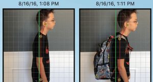 Ghid parental de depistare precoce a scoliozei și cifozei la copii Sursa: chirohealthwellness.com